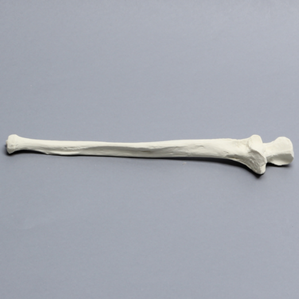 Ulna, 5mm Canal, Solid Foam, Right