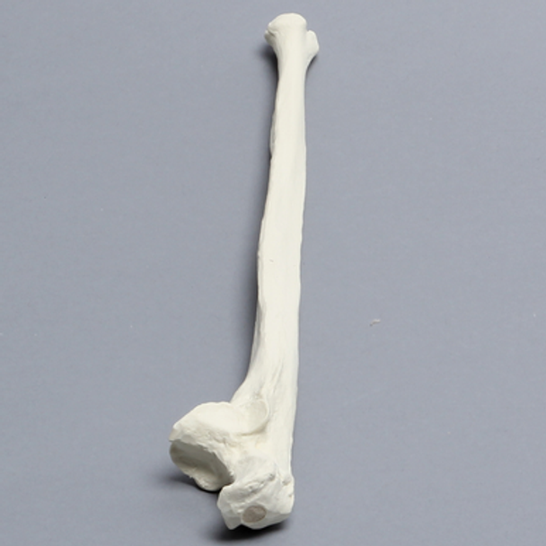 Ulna, 5mm Canal, Solid Foam, Right
