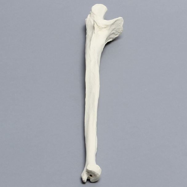 Ulna, 5mm Canal, Solid Foam, Right