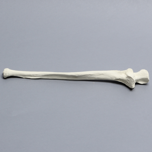 Ulna, 5mm Canal, Solid Foam, Right