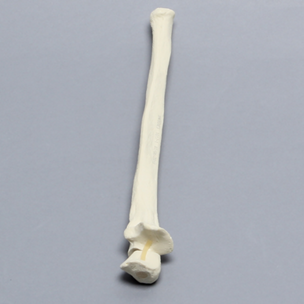 Ulna with Olecranon Fracture, Solid Foam