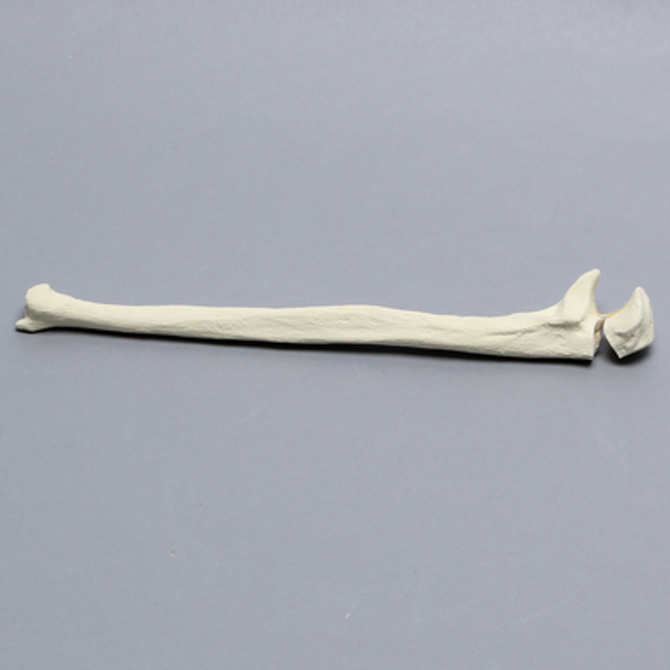Ulna with Olecranon Fracture, Solid Foam