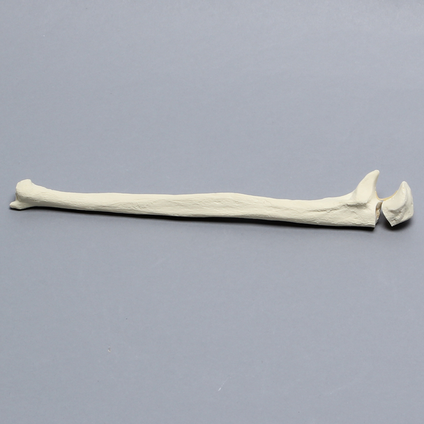 Ulna with Olecranon Fracture, Solid Foam