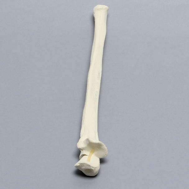 Ulna with Olecranon Fracture, Solid Foam