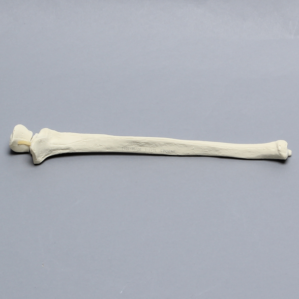 Ulna with Olecranon Fracture, Solid Foam