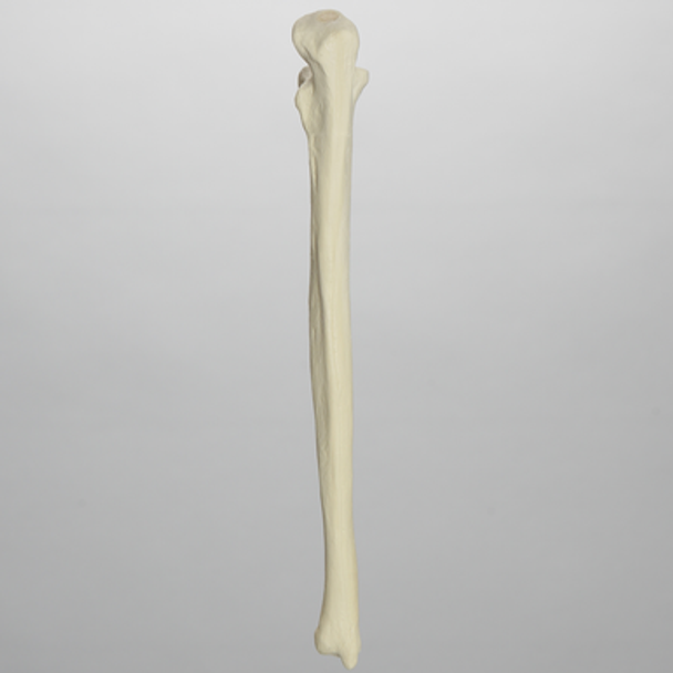 Ulna, 5mm Canal, Solid Foam, Left