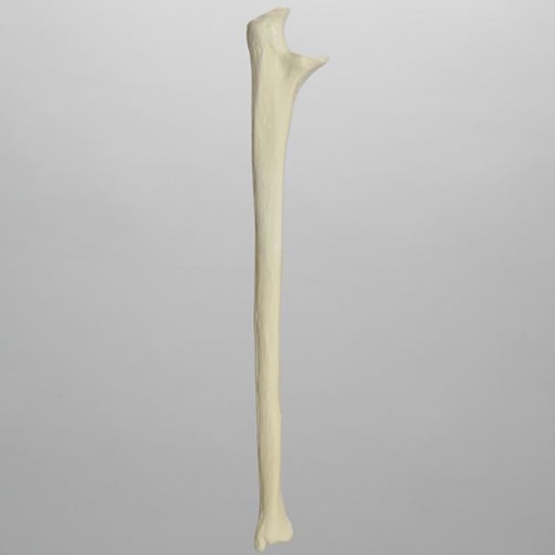 Ulna, 5mm Canal, Solid Foam, Left
