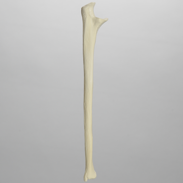 Ulna, 5mm Canal, Solid Foam, Left