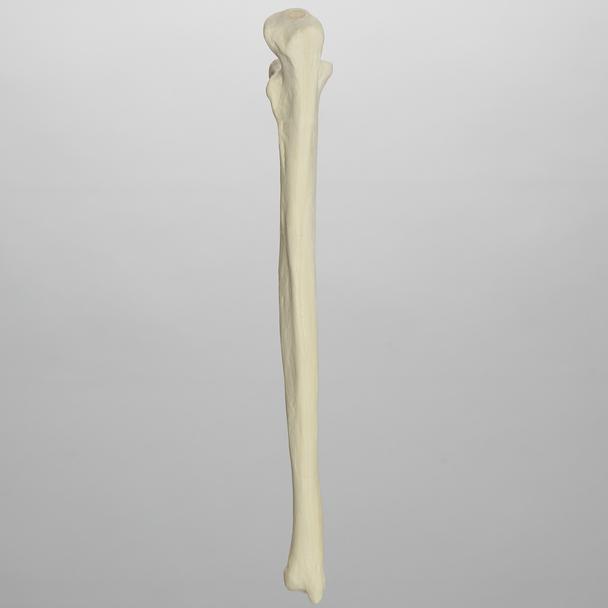 Ulna, 5mm Canal, Solid Foam, Left