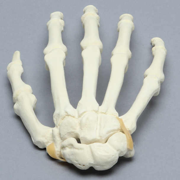 Hand with Moveable Carpal Section, Solid Foam