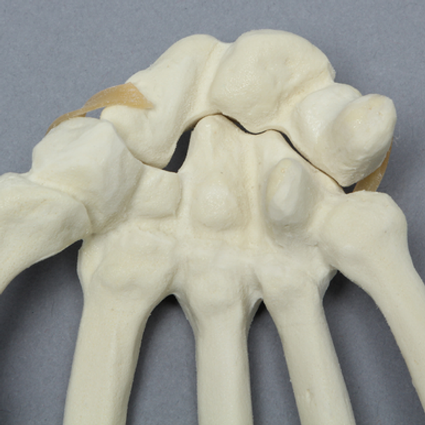 Hand with Moveable Carpal Section, Solid Foam