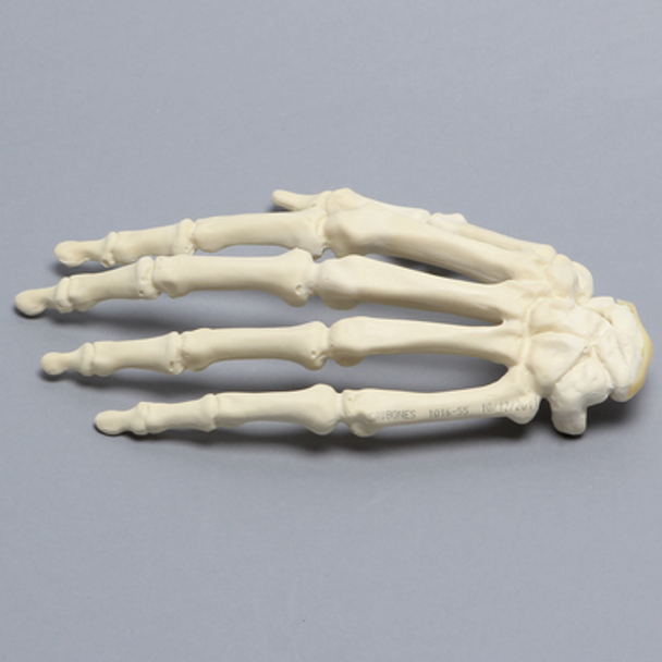 Hand with Scaphoid Fracture, Solid Foam