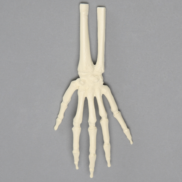 Hand and Wrist, Pediatric, Solid Foam