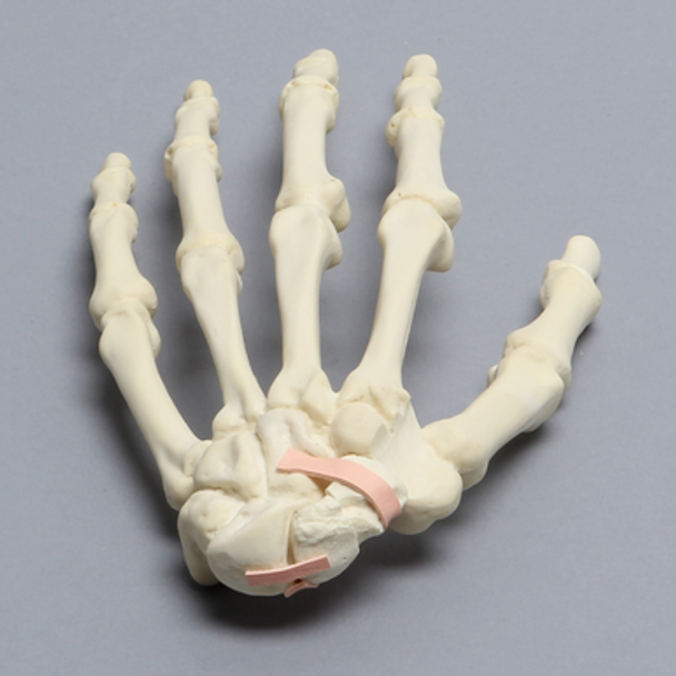 Hand with Scaphoid Fracture and Ligament, Solid Foam