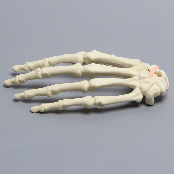 Hand with Scaphoid Fracture and Ligament, Solid Foam