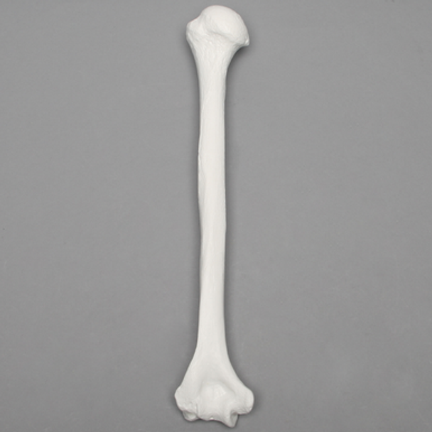Humerus, 9.5mm Canal, Plastic Cortical Shell