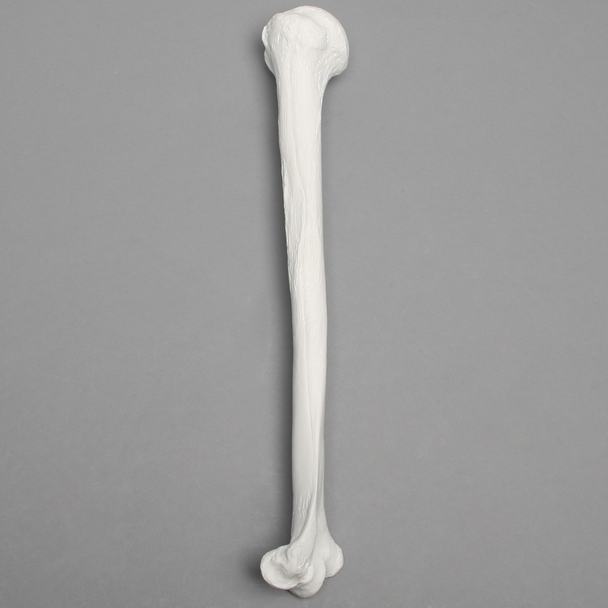 Humerus, 9.5mm Canal, Plastic Cortical Shell