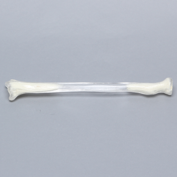 Radius, 5.5mm Canal, Transparent Cortical