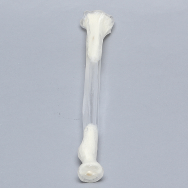 Radius, 5.5mm Canal, Transparent Cortical
