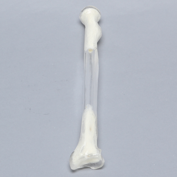 Radius, 5.5mm Canal, Transparent Cortical