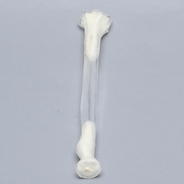 Radius, 5.5mm Canal, Transparent Cortical