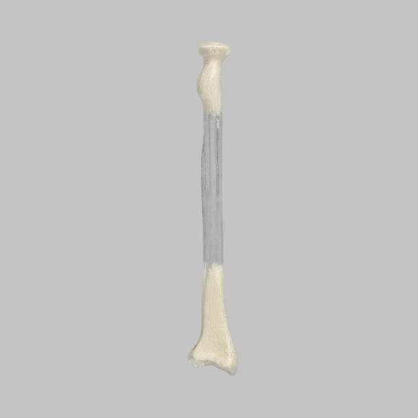Radius, 5.5mm Canal, Transparent Cortical