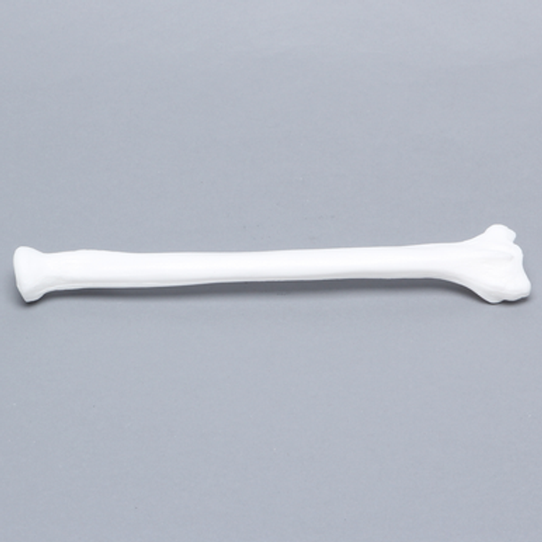 Radius, Solid White Plastic, Left