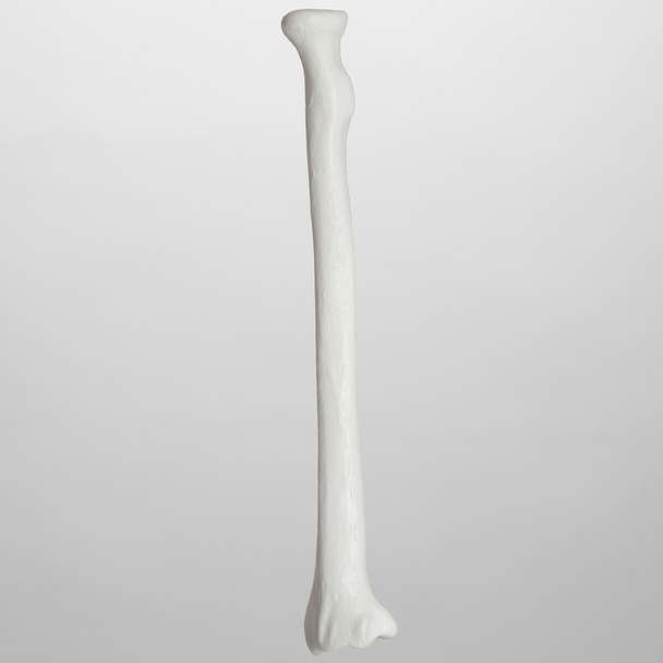 Radius, 5.5 mm Canal, Plastic Cortical Shell