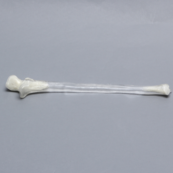 Ulna, 5mm Canal, Transparent Cortical