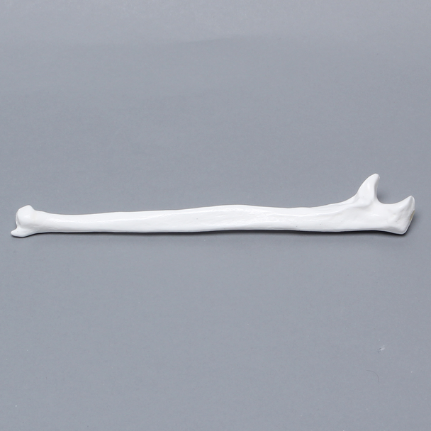 Ulna, 5mm Canal, Plastic Cortical