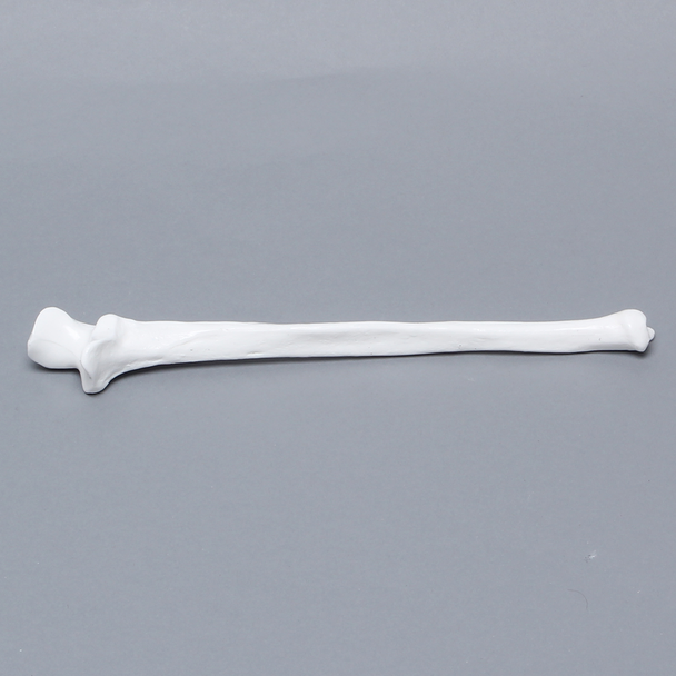 Ulna, 5mm Canal, Plastic Cortical
