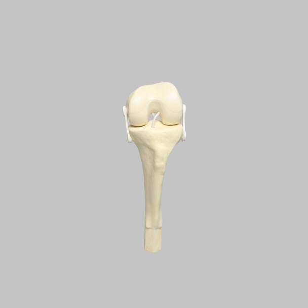 Converge™ Medium Left Knee with Stretch Collateral and Cruciate Ligaments