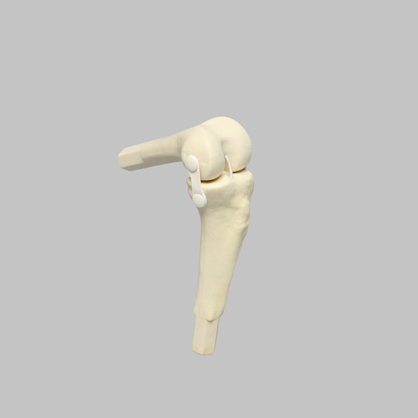 Converge™ Medium Left Knee with Stretch Collateral and Cruciate Ligaments