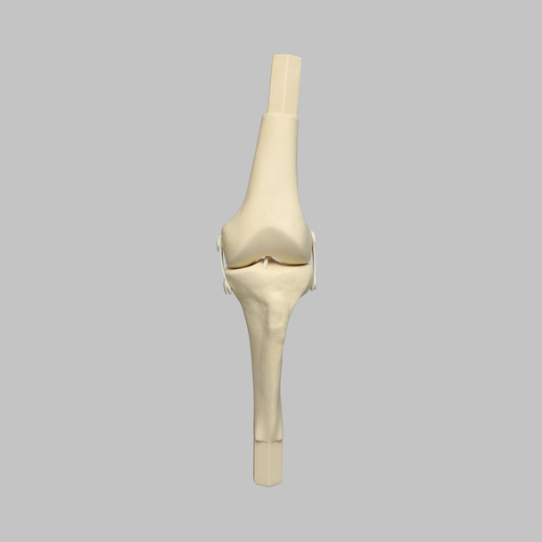 Converge™ Medium Left Knee with Non-Stretch Collateral and Cruciate Ligaments