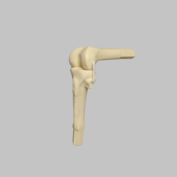 Converge™ Medium Left Knee with 7­­ Degree Varus Tibia