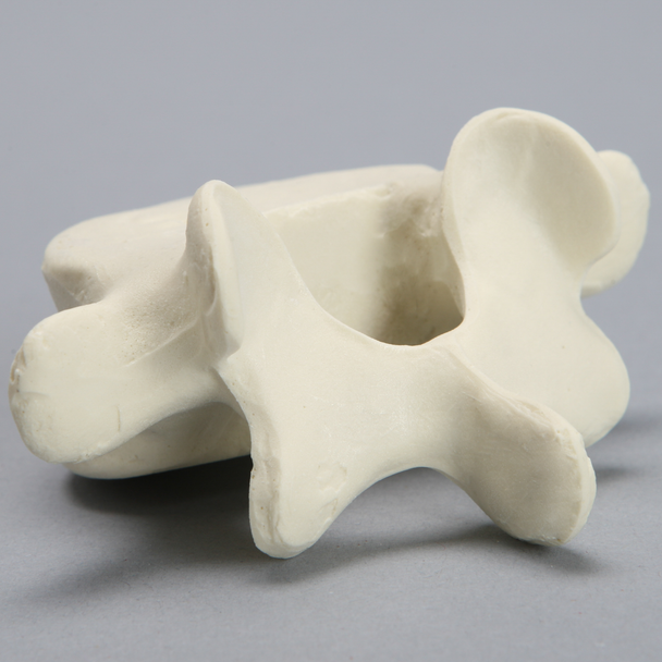 Vertebra, L5, Foam Cortical