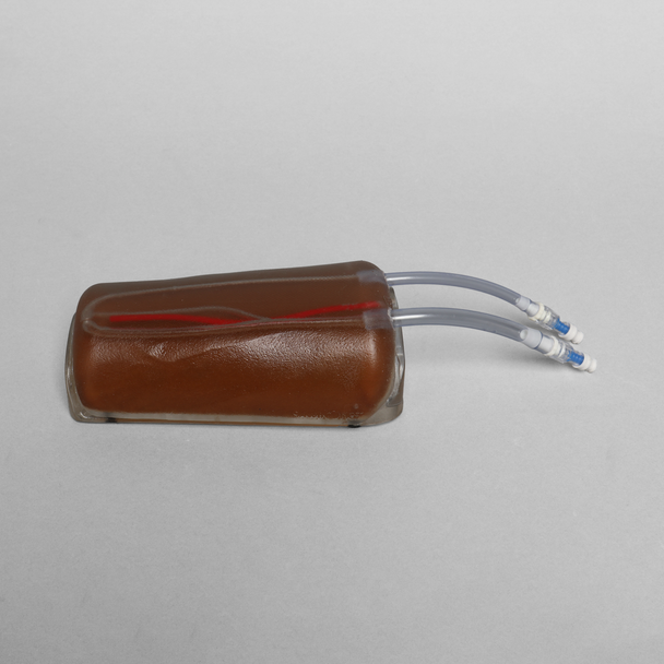 Ultrasound Branching 3-Vein Access with Artery Replacement, Clear Tone