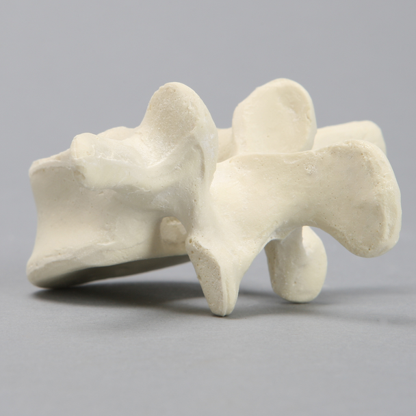 Vertebra, L3, Solid Foam