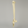 Foot and Ankle with Clubfoot and Equinus Deformities