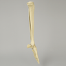Foot and Ankle with Clubfoot and Equinus Deformities