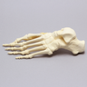 Foot with Valgus Deformity