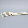 Hand and Wrist with Four-Part Fracture with Displacement, Foam Cortical
