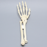 Hand and Wrist with Four-Part Fracture with Displacement, Foam Cortical