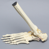 Foot and Ankle with Calcaneal and Talus Fracture