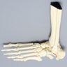 Foot and Ankle with Calcaneal and Talus Fracture