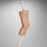 Knee with Fractures, Encased