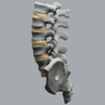 Spine, Lumbar, Bilateral Iliac Crests, Radiopaque