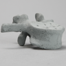 Vertebra, L2, Osteoporotic, Radiopaque