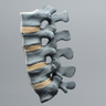 Spine, Lumbar Vertebrae, L1-L5, Radiopaque