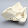 Pelvis with Global and Rim Defects, Full Male, Foam Cortical